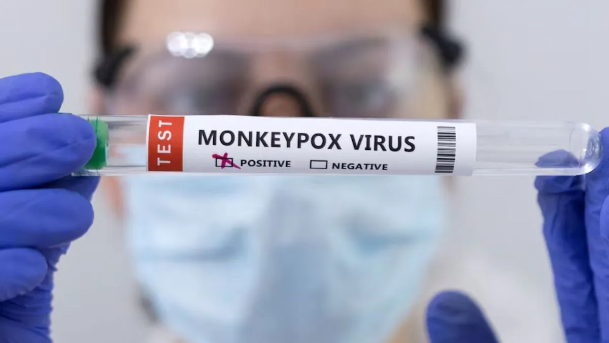 mpox-scare-indian-international-airports-border-entry-points-vigilant-3-delhi-nodal-hospitals-mpox-clade-1-variant-sweden-who-news